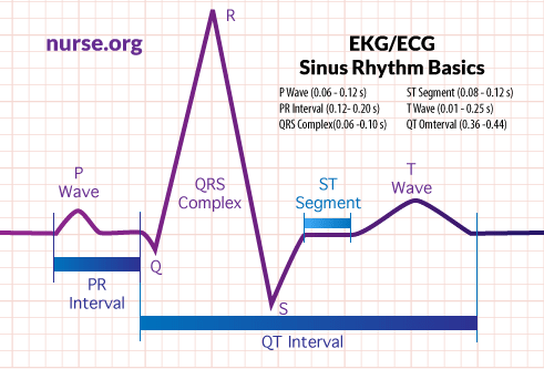 Understanding EKG Interpretation