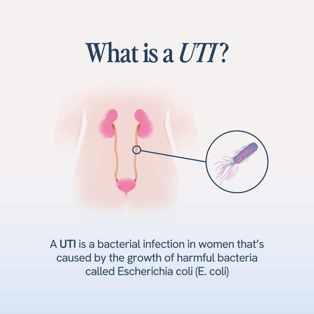 Ways to prevent UTI after sex